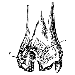 Lower end of a thigh bone