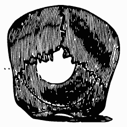 Skull base with a round opening