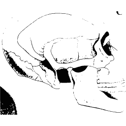 Skull seen from the side