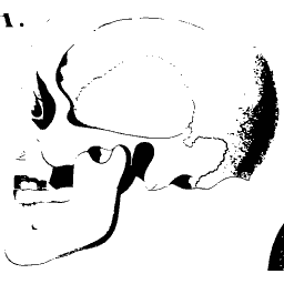 Bones of the face in profile