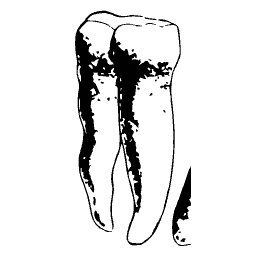 Molar tooth seen from the side