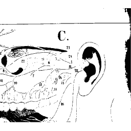 Side of the head with the ear
