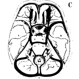 Horizontal section of the brain
