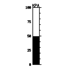 Vertical scale 12