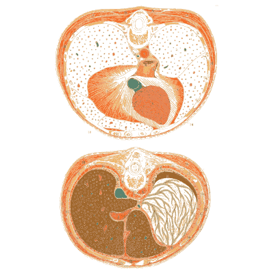 Cross sections of the trunk - An Atlas of Anatomy, or Pictures of the Human Body - 1879