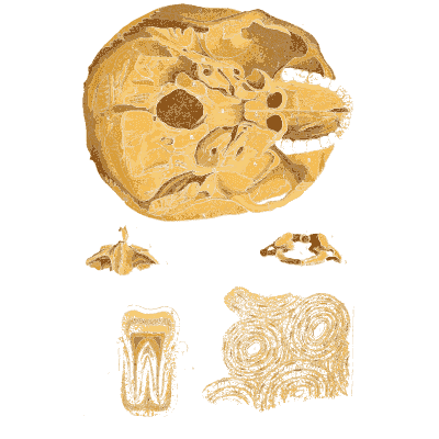Base of the skull from below - An Atlas of Anatomy, or Pictures of the Human Body - 1879