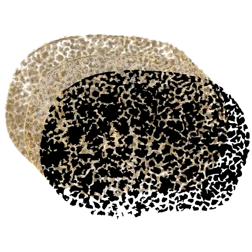 Speckled puffball
