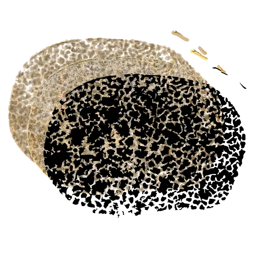 Speckled puffball